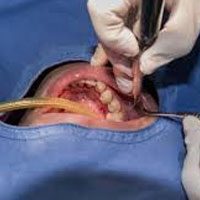 espec-cirurgia espec-cirurgia