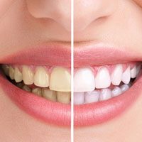 espec-periodontia espec-periodontia