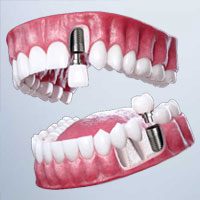 espec-protese-dentaria espec-protese-dentaria