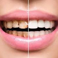espec-reabilitacao-oral espec-reabilitacao-oral